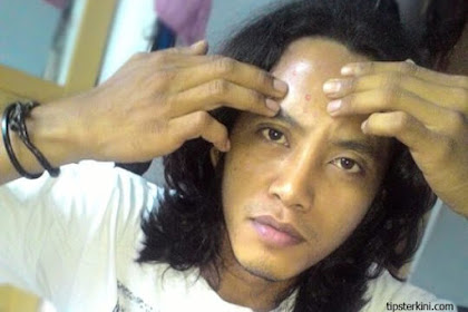 Mitos Dan Fakta Seputar Jerawat